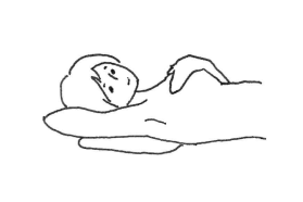 乳がんイラスト