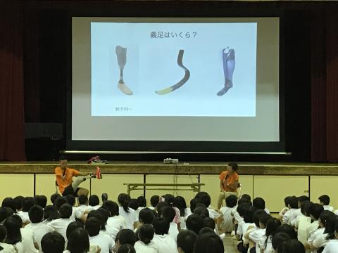 池田選手がモニターで義足の説明をしている写真